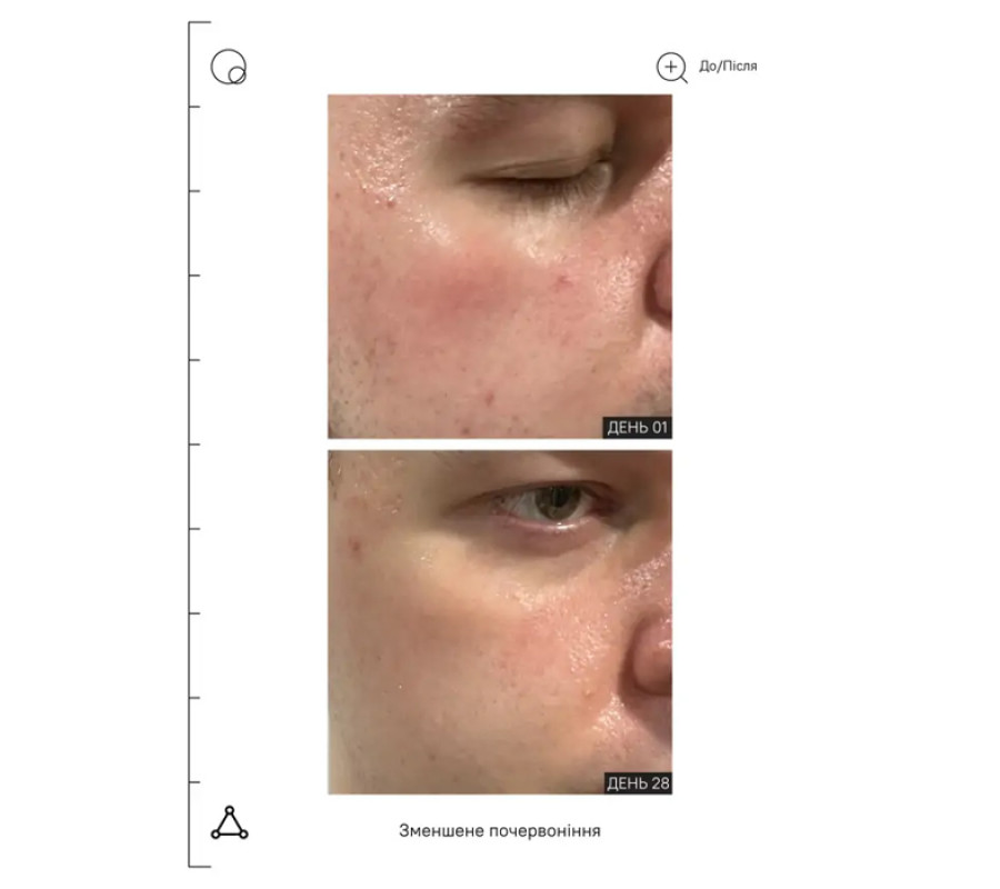 Бустер з пребіотиками та ніацинамідом Prebiotics & Niacinamide Pore Refining Booster Allies of Skin, 50 мл