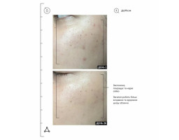 Сироватка з вітаміном С для обличчя 20% Vitamin C Brighten + Firm Serum Allies of Skin, 30 мл