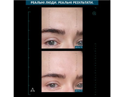 Сироватка мультипептидна з ефектом ліфтингу Multi Peptides & GF Advanced Lifting Serum Allies of Skin, 30 мл