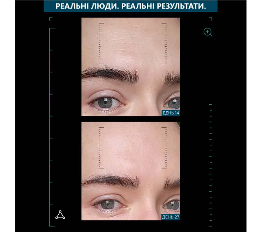 Сироватка мультипептидна з ефектом ліфтингу Multi Peptides & GF Advanced Lifting Serum Allies of Skin, 30 мл