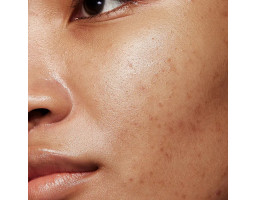 Сироватка нічна для обличчя Mandelic Pigmentation Corrector Night Serum Allies of Skin, 30 мл