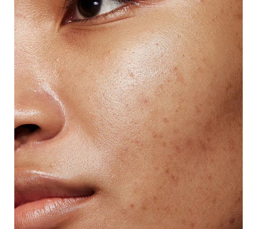 Сироватка нічна для обличчя Mandelic Pigmentation Corrector Night Serum Allies of Skin, 30 мл