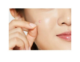 Патчі від акне Clear Fit Master Patch COSRX, 18 шт