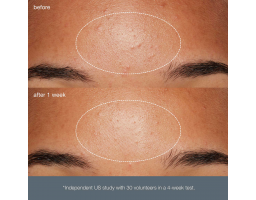 Dermalogica Daily Microfoliant — щоденний мікрофоліант, 40 г