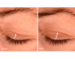 Dermalogica Phyto Nature Lift Eye Cream — трансформуючий ліфтинг-крем для шкіри навколо очей