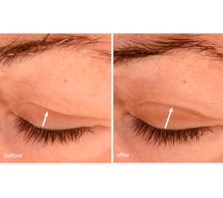 Dermalogica Phyto Nature Lift Eye Cream — трансформуючий ліфтинг-крем для шкіри навколо очей