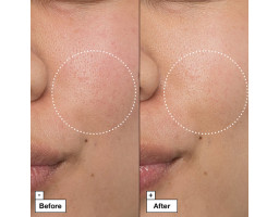 Інтенсивно заспокійливий і регенерувальний крем Cicapair Intensive Soothing Repair Cream (туба) Dr.Jart+, 50 мл