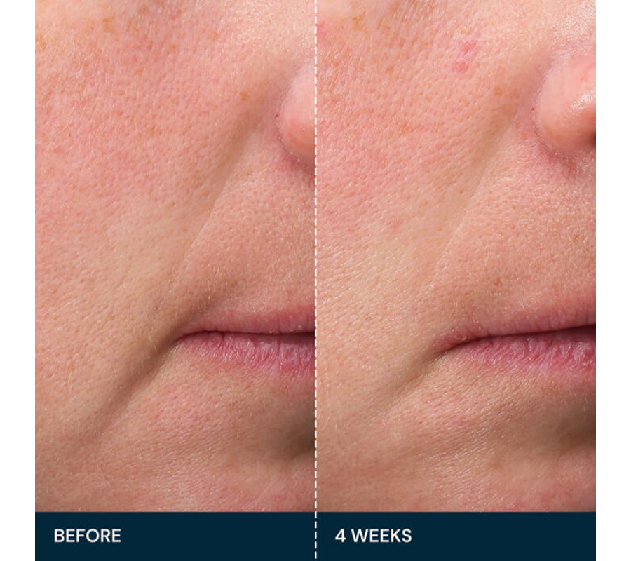 Зміцнювальна сироватка для обличчя Pro-Collagen Future Restore Serum ELEMIS, 15 мл