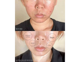 Крем для корекції темних плям із базиліком BYROE, 30 мл