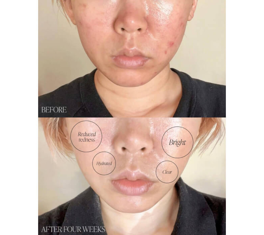 Крем для корекції темних плям із базиліком BYROE, 30 мл