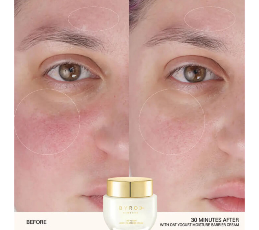 Крем восстановление защитного барьера чувствительной кожи Oat Yogurt Moisture Barrier Cream Byroe, 5