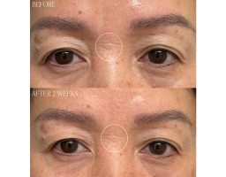 Крем с тыквенным про-ретинолом Pumpkin Pro-Retinol Cream BYROE ,50 мл