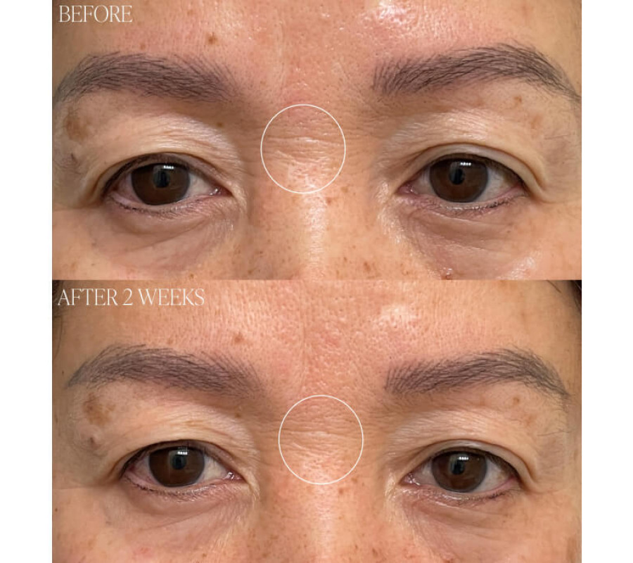 Крем с тыквенным про-ретинолом Pumpkin Pro-Retinol Cream BYROE ,50 мл