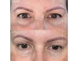 Крем с тыквенным про-ретинолом Pumpkin Pro-Retinol Cream BYROE ,50 мл