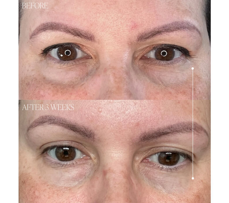 Крем с тыквенным про-ретинолом Pumpkin Pro-Retinol Cream BYROE ,50 мл