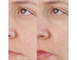 Увлажняющий гель с капустой Kale Hydrating Gel Moisturizer BYROE, 50 мл