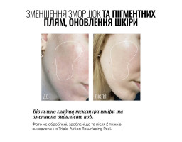 Пілінг для обличчя Triple Action Resurfacing Peel Instytutum, 60 мл