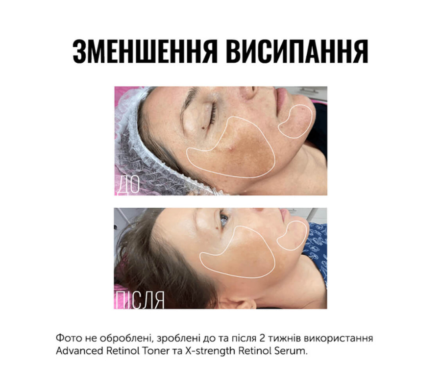 Тонер з ретинолом Advanced Retinol Toner Instytutum, 50 мл