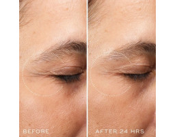 Ночной крем вокруг глаз с ретиналем 0,03 Crystal Retinal Ceramide Eye 3 Medik8, 15 мл