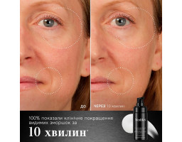 Інноваційна антивікова сироватка для обличчя Liquid Peptides Advanced MP Serum Medik8, 30 мл