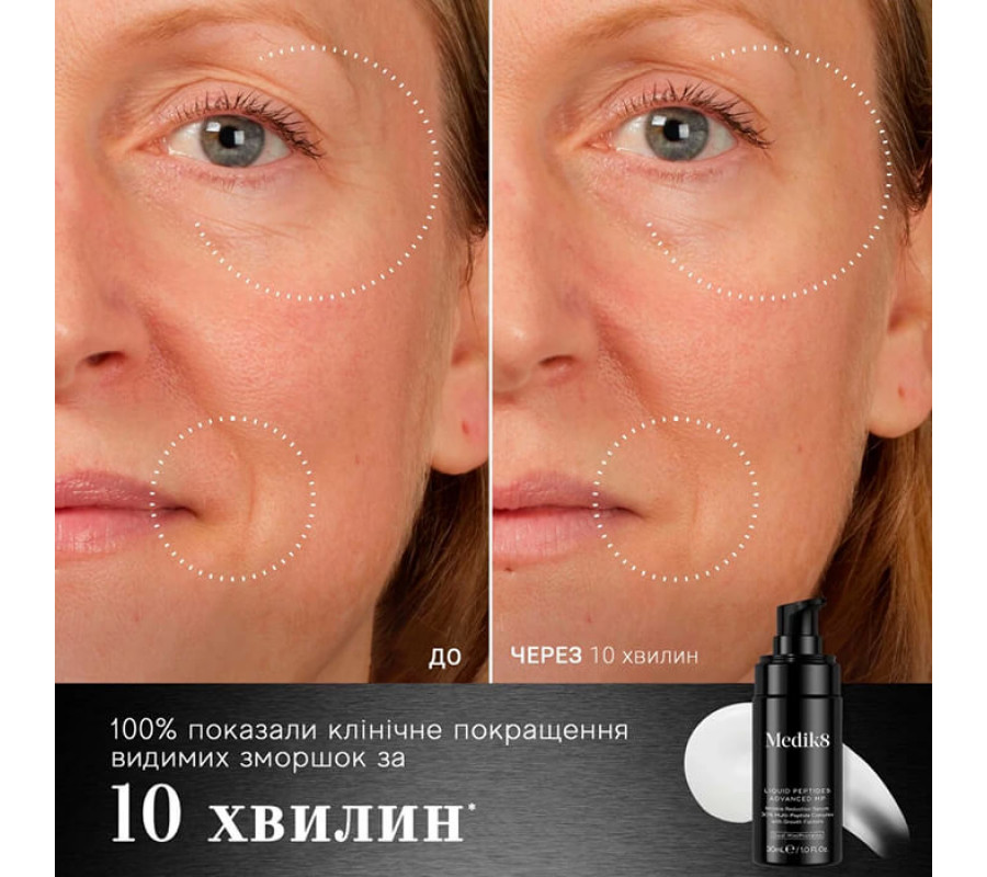 Інноваційна антивікова сироватка для обличчя Liquid Peptides Advanced MP Serum Medik8, 30 мл