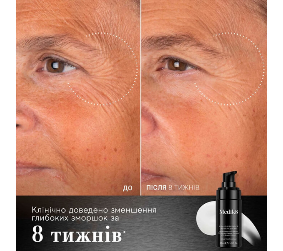 Інноваційна антивікова сироватка для обличчя Liquid Peptides Advanced MP Serum Medik8, 30 мл