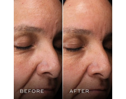 Двоетапна нічна маска для обличчя H.E.O Mask Medik8, 2*50 мл