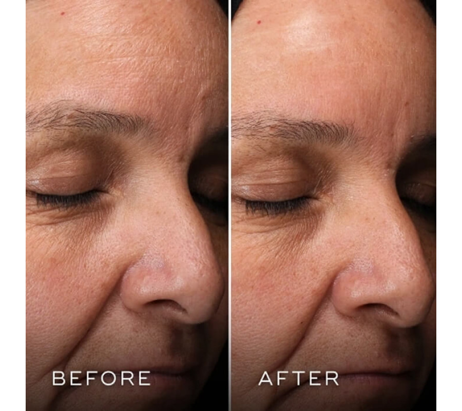 Двоетапна нічна маска для обличчя H.E.O Mask Medik8, 2*50 мл